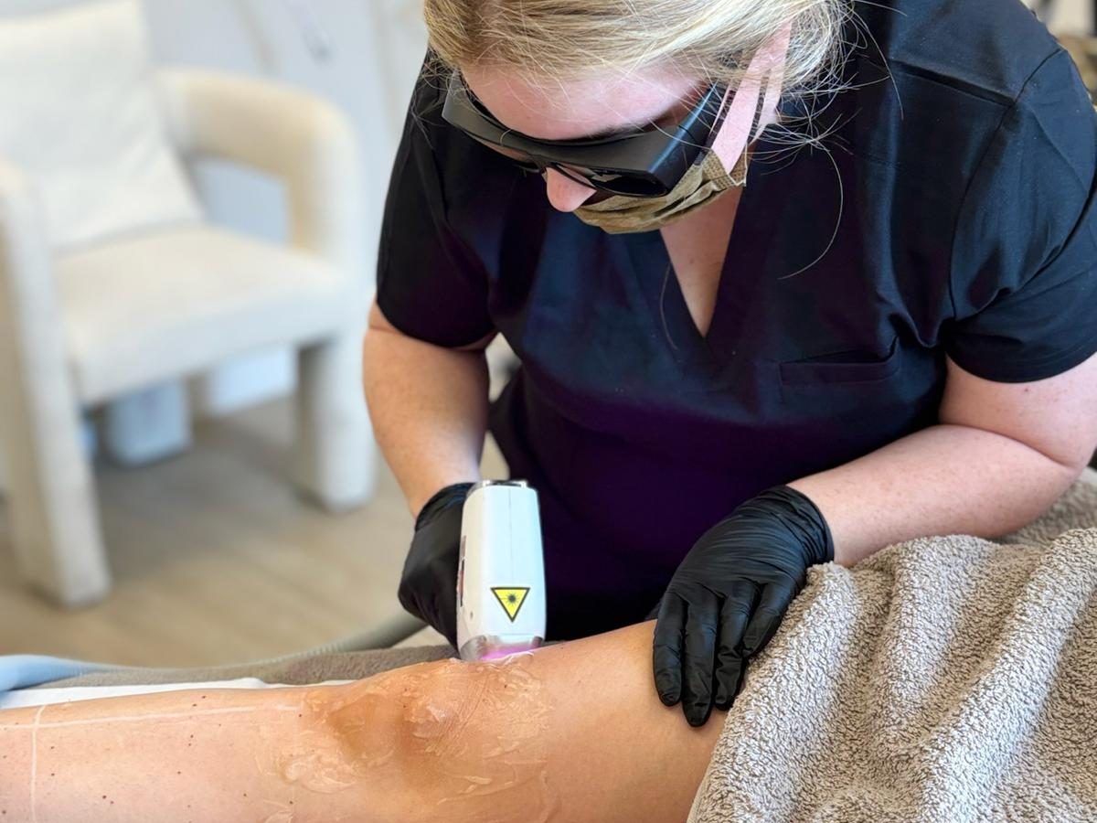 Laser hair removal Rainford