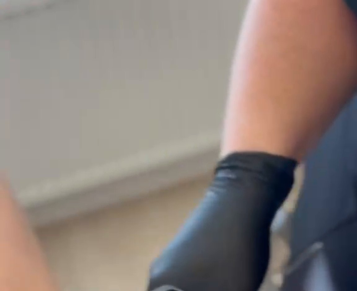 Laser handpiece in use
