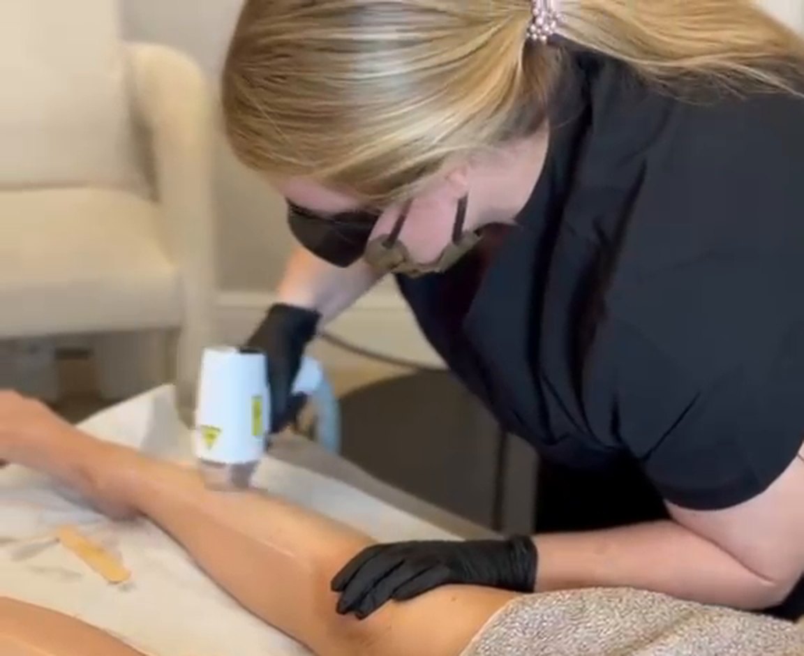 Laser hair removal treatment Rainford